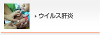 ウイルス肝炎
