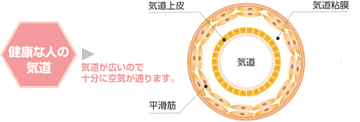 健康な人の気道の説明のイラスト