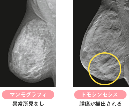 トモセンシス