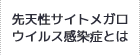 先天性サイトメガロウイルス感染症とは