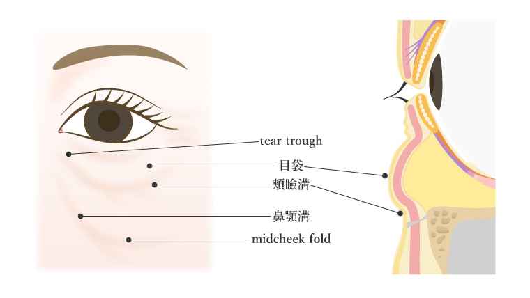 下まぶたのシワと構造