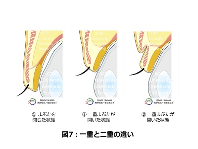 一重と二重の違ちがい