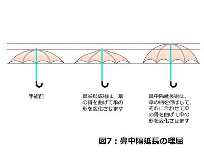 鼻中隔延長の理屈