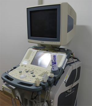 超音波検査診断装置