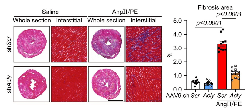 Angiotensin-II/Phenylephrineによって誘導される心臓線維化がAcly遺伝子発現サイレンシングによって、抑制された(マッソントリクローム染色)。