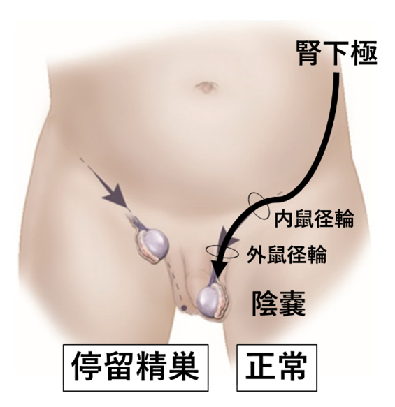 停留精巣 移動性精巣 神戸大学医学部附属病院小児外科
