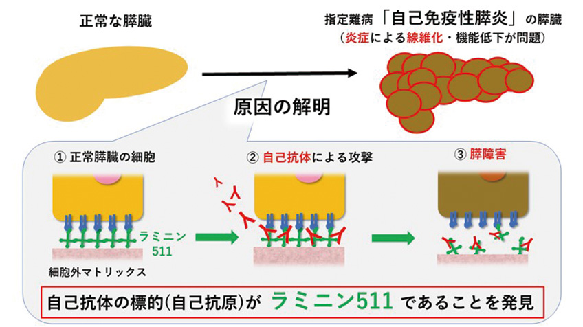 自己免疫性膵炎の自己抗原の発見