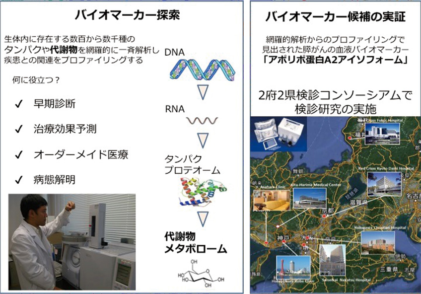 自己免疫性膵炎の自己抗原の発見