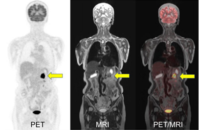 PET-MRI