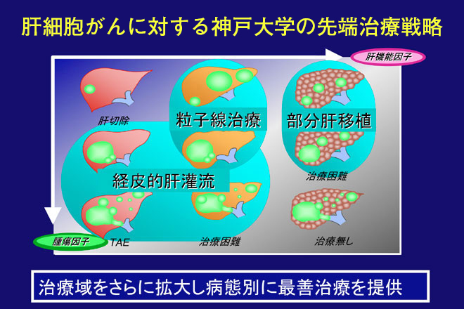 肝細胞がんに対する神戸戦略
