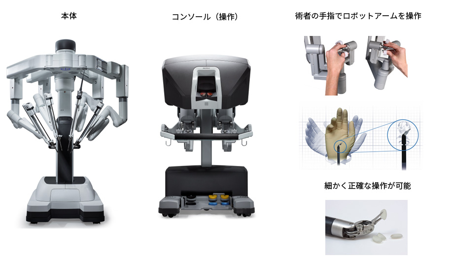 ロボット支援下手術（daVinci）