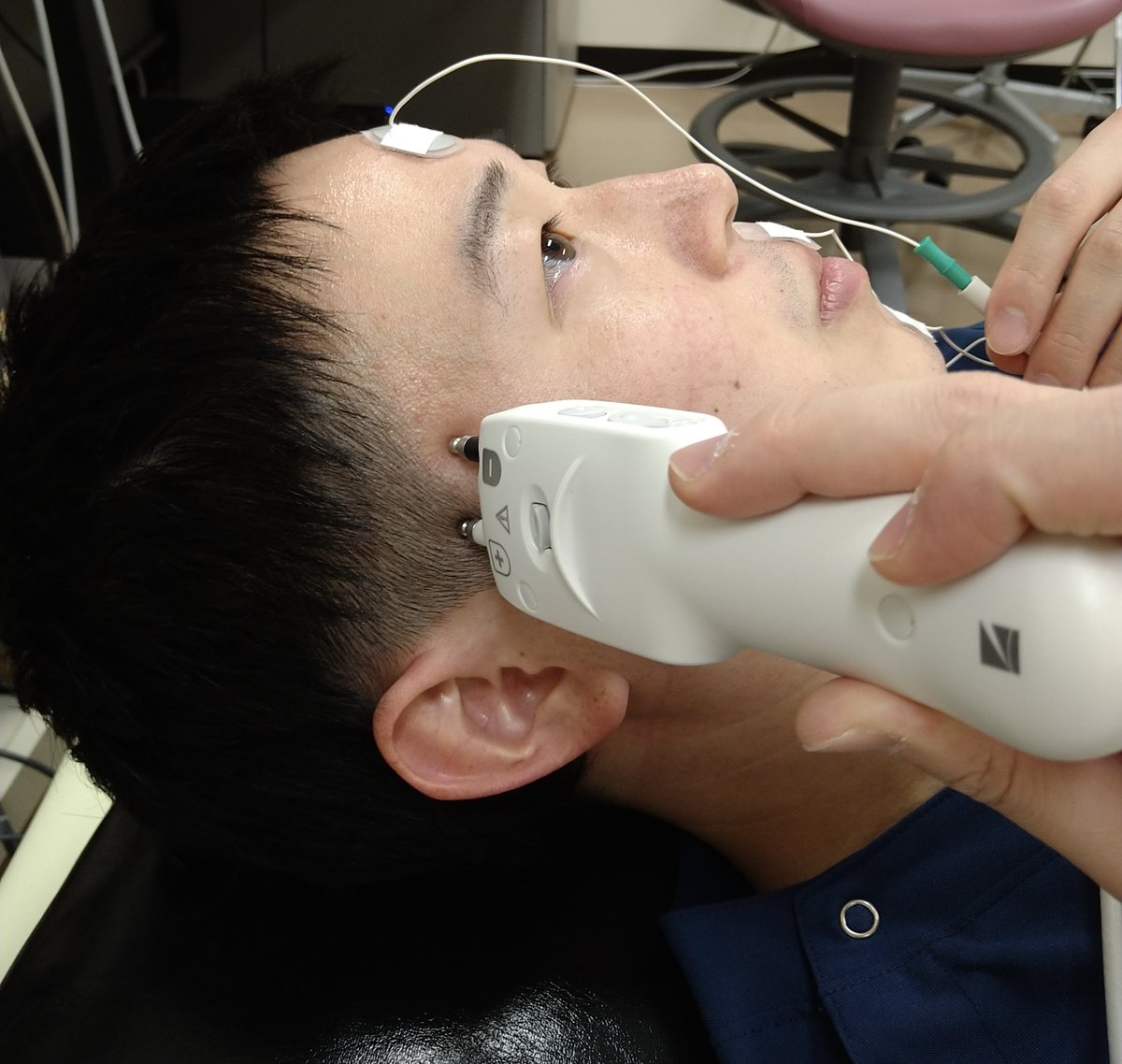 顔面神経の電気生理検査(ENoG)を行っている様子