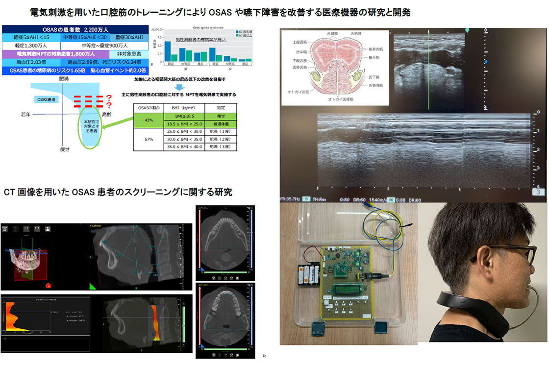電気刺激を用いた口腔筋のトレーニングにより閉塞性睡眠時無呼吸症候群(OSAS)や嚥下障害を改善する医療機器の研究と開発