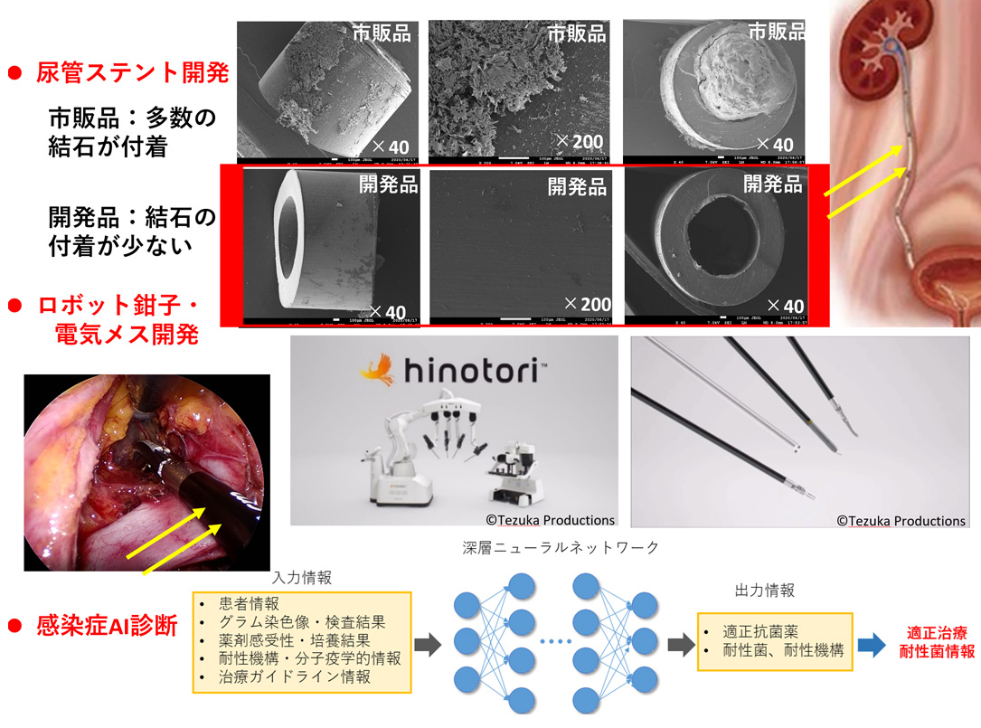 尿管ステント開発