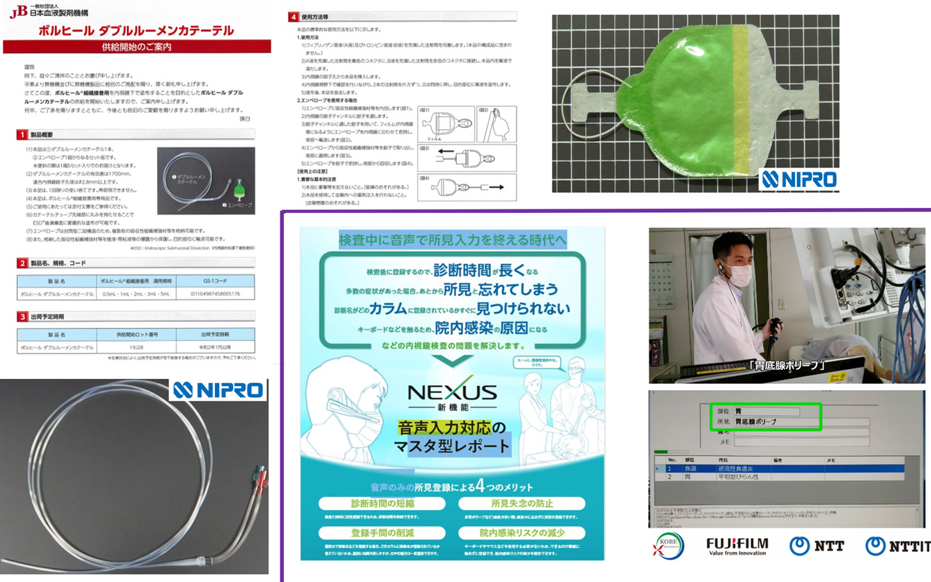 フィブリン糊の消化管内使用に関する研究