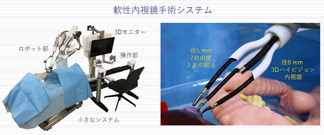 軟性内視鏡手術システム