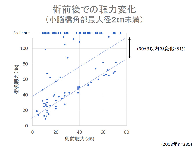 術前後での聴力変化