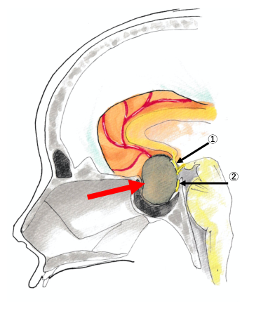 頭蓋底外科とは？