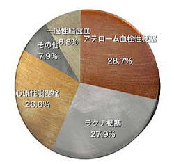 脳梗塞の外科的治療