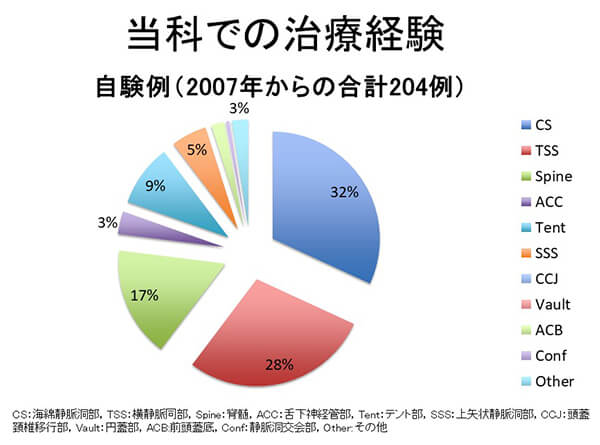 硬膜動静脈瘻に対する塞栓術