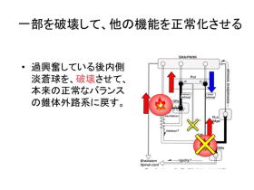 パーキンソン氏病の治療