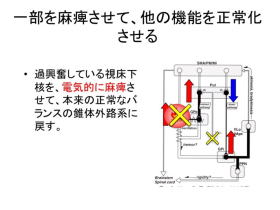 パーキンソン氏病の治療