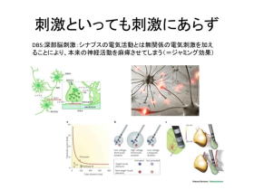 パーキンソン氏病の治療