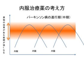 パーキンソン氏病の治療