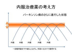 パーキンソン氏病の治療