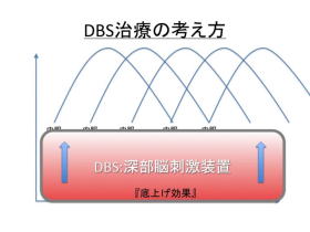 パーキンソン氏病の治療