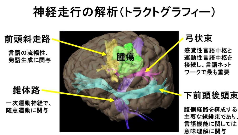 術前画像解析