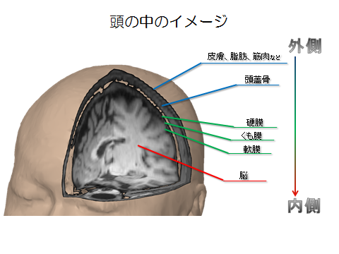 頭部外傷