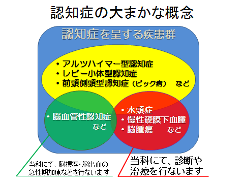 アルツハイマー 型 認知 症 と は