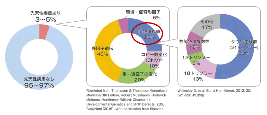 先天性疾患と染色体疾患